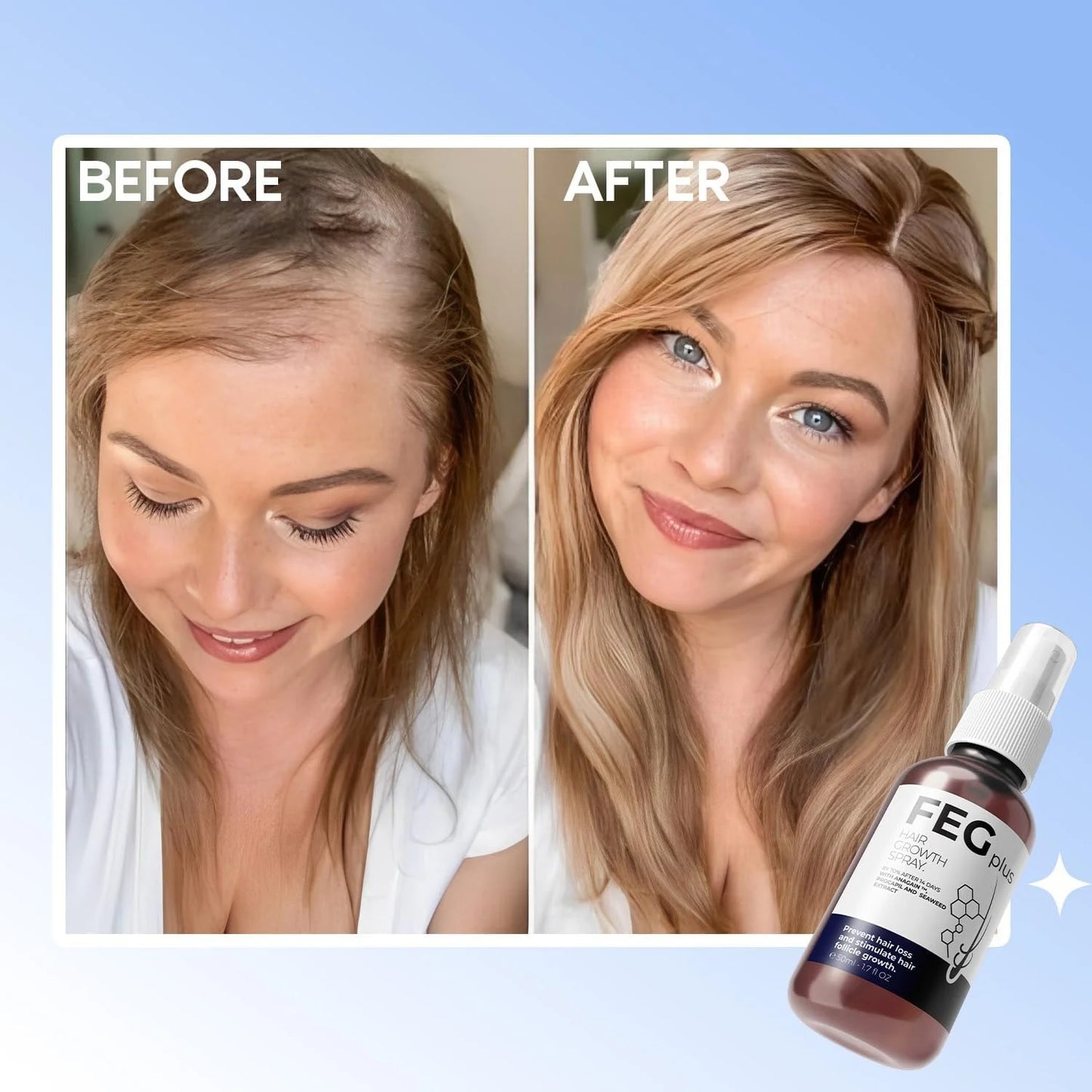 FEG Hair Growth Spray PLUS 50mL (Original)