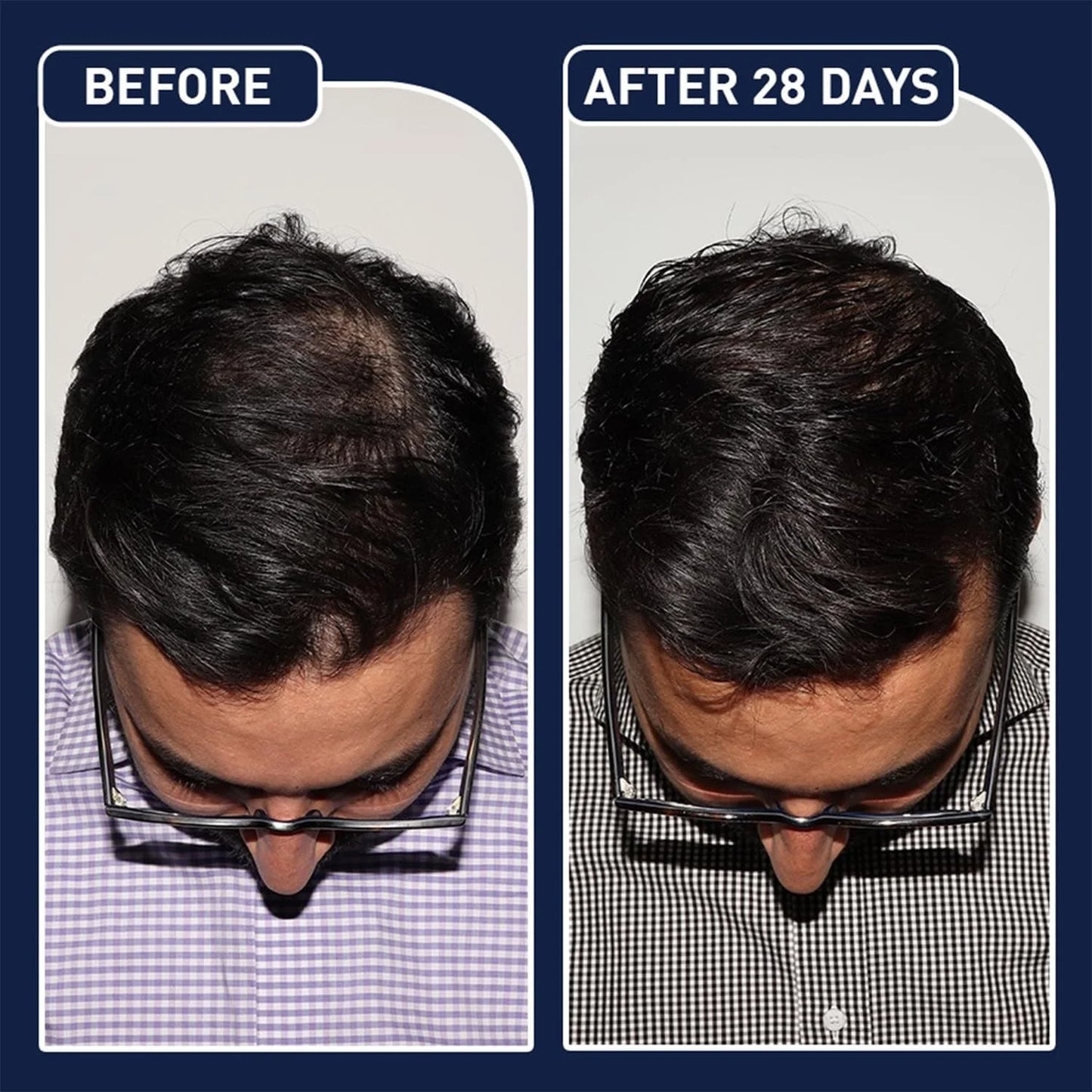 FEG Hair Growth Spray PLUS 50mL (Original)