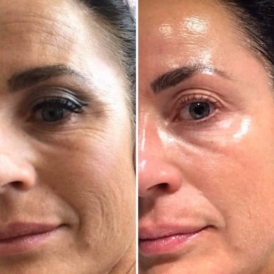 Retinal Shot Skin Tightening Booster Original 15ml