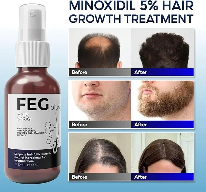 FEG Hair Growth Spray PLUS 50mL (Original)