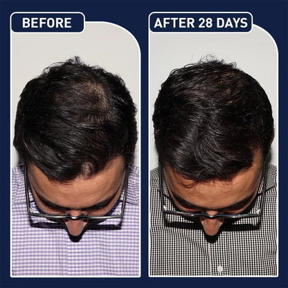 FEG Hair Growth Spray PLUS 50mL (Original)